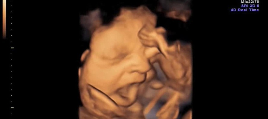 Anne karnındaki bebeğin esnemesi görüntülendi