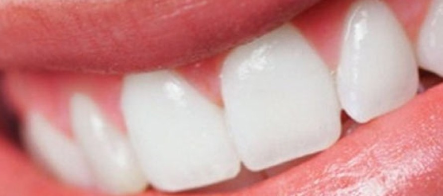 Piyasada satılan diş beyazlatma ürünlerine dikkat!