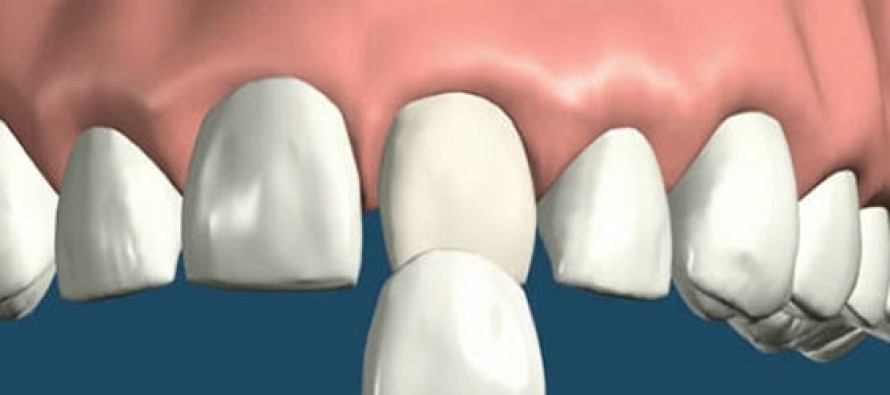 Diş aralıklarının artması, hipofiz bezi hastalığının belirtisi olabilir