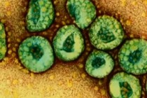SAĞLIK – Amerika’ya sıçrayan Mers virüsü nedir? Nasıl korunulur?