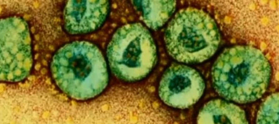 SAĞLIK – Amerika’ya sıçrayan Mers virüsü nedir? Nasıl korunulur?