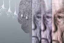 Facebook’tan ‘Alzheimer’ farkındalığını artıracak uygulama!