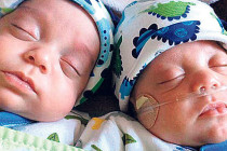 İkiz kardeşler 39 gün arayla dünyaya geldi