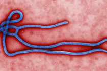 California’da Ebola şüphesi