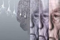 Alkol ve stres, Alzheimer hastalığını tetikliyor