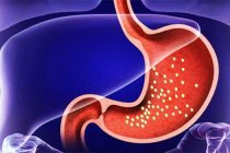 Tedavi edilmeyen gastrit, mide kanserine yol açabilir