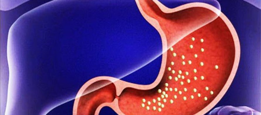 Tedavi edilmeyen gastrit, mide kanserine yol açabilir
