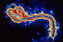 Taylandlı doktorlardan Ebola için ‘antikor tedavisi’