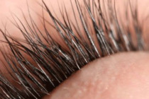 Gözlerdeki batma, kirpik dibi iltihabının habercisi olabilir