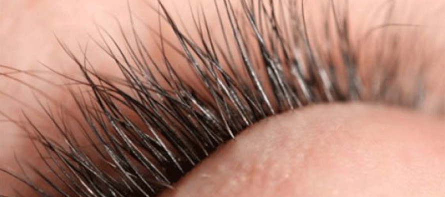 Gözlerdeki batma, kirpik dibi iltihabının habercisi olabilir
