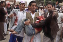 BM: Yemen’de sivil kayıplar artıyor