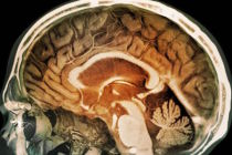 Beyinle beden arasında yeni bağlantılar ortaya çıktı