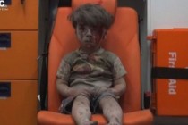 5 yaşındaki Ümran Suriye savaşının sembolü oldu