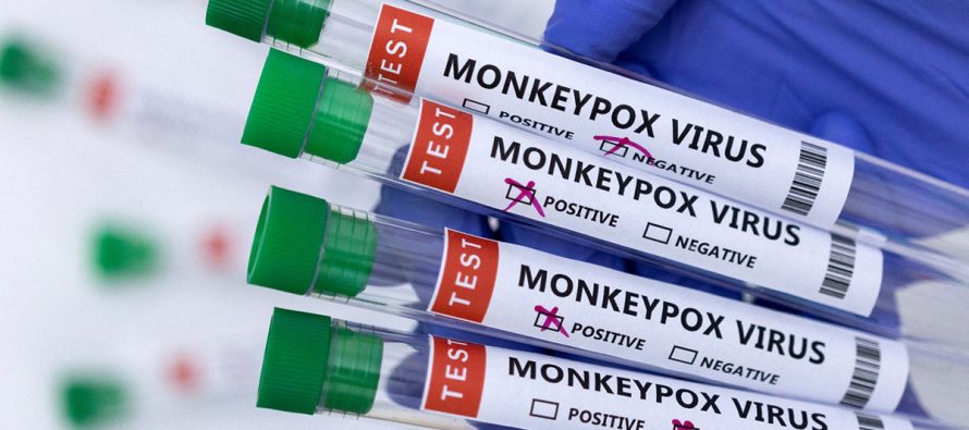 Uzmanlardan Maymun Çiçeği  virüsü uyarısı: Test yaptırmayı ihmal etmeyin